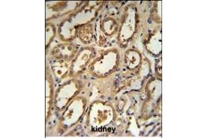 DCP2 Antibody (Center) (ABIN653129 and ABIN2842708) IHC analysis in formalin fixed and paraffin embedded human kidney tissue followed by peroxidase conjugation of the secondary antibody and DAB staining. (DCP2 Antikörper  (AA 144-173))