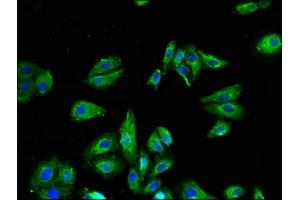 Immunofluorescent analysis of HepG2 cells using ABIN7172875 at dilution of 1:100 and Alexa Fluor 488-congugated AffiniPure Goat Anti-Rabbit IgG(H+L) (TRPV1 Antikörper  (AA 1-155))