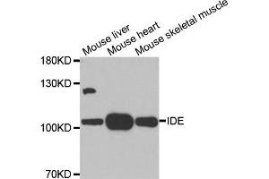 Western blot analysis of extracts of various tissues, using IDE antibody. (IDE Antikörper)