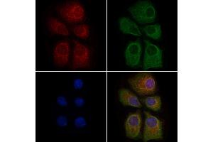 ABIN6263370 and ABIN6279022 staining HepG2 cells by IF/ICC. (MRPL37 Antikörper  (N-Term))