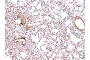 IHC analysis of TIMM17A using anti-TIMM17A antibody (ABIN6719637). (TIMM17A Antikörper)