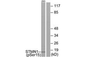 Western blot analysis of extracts from 293 cells, using Stathmin 1 (Phospho-Ser15) Antibody. (Stathmin 1 Antikörper  (pSer16))