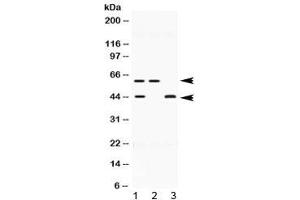 Western blot testing of human 1) HeLa, 2) U-2 OS and 3) MCF7 lysate with E2F4 antibody at 0. (E2F4 Antikörper  (AA 106-144))