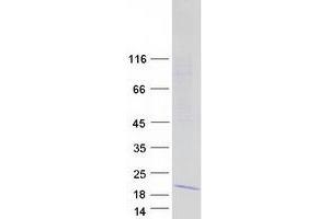 Validation with Western Blot (IFITM5 Protein (Myc-DYKDDDDK Tag))