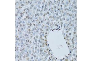 Immunohistochemistry of paraffin-embedded rat liver using HNF4A Antibody (ABIN5971111) at dilution of 1/100 (40x lens). (HNF4A Antikörper)