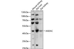 Western blot analysis of extracts of various cell lines, using AADAC antibody (ABIN6129182, ABIN6136311, ABIN6136313 and ABIN6218113) at 1:1000 dilution. (AADAC Antikörper  (AA 170-399))