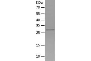 Western Blotting (WB) image for Zinc Finger Protein 268 (ZNF268) (AA 8-263) protein (His tag) (ABIN7125782) (ZNF268 Protein (AA 8-263) (His tag))