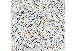IHC analysis of NKX2-3 using anti-NKX2-3 antibody (ABIN7825614).