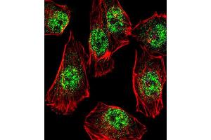 Immunofluorescence (IF) image for anti-Rhox Homeobox Family, Member 2B (RHOXF2B) antibody (ABIN3000753) (RHOXF2B Antikörper)