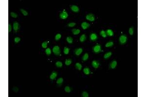 Immunofluorescence staining of Hela cells with ABIN7174097 at 1:133, counter-stained with DAPI.