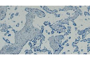 ABIN334408 Negative Control showing staining of paraffin embedded Human Placenta, with no primary antibody. (GBX2 Antikörper  (Internal Region))