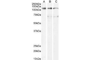 ABIN5539567 (1µg/ml) staining of U937 (A) and (0. (Oncostatin M Receptor Antikörper  (Internal Region))