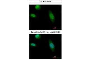 Image no. 3 for anti-RAD23 Homolog B (RAD23B) (AA 164-409) antibody (ABIN1500578) (RAD23B Antikörper  (AA 164-409))