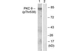 Western blot analysis of extracts from Jurkat cells, using PKC thet (Phospho-Thr538) Antibody. (PKC theta Antikörper  (pThr538))