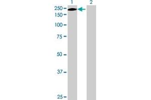 Western Blot analysis of ERCC5 expression in transfected 293T cell line by ERCC5 MaxPab polyclonal antibody. (ERCC5 Antikörper  (AA 1-1186))