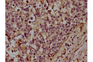 Immunohistochemistry (IHC) image for anti-CD14 (CD14) (AA 20-345) antibody (ABIN7160185)