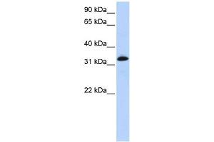 Troponin T Type 2 antibody used at 1 ug/ml to detect target protein. (Cardiac Troponin T2 Antikörper)