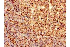 Immunohistochemistry of paraffin-embedded human pancreatic tissue using ABIN7172642 at dilution of 1:100 (SOX9 Antikörper  (AA 296-501))