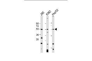 All lanes : Anti-VEGFC Antibody at 1:2000 dilution Lane 1: 293 whole cell lysate Lane 2: K562 whole cell lysate Lane 3: HepG2 whole cell lysate Lysates/proteins at 20 μg per lane. (VEGFC Antikörper)