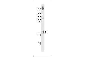 Western blot analysis of FA96B Antibody (N-term) (ABIN653317 and ABIN2842809) in  cell line lysates (35 μg/lane). (FAM96B Antikörper  (N-Term))