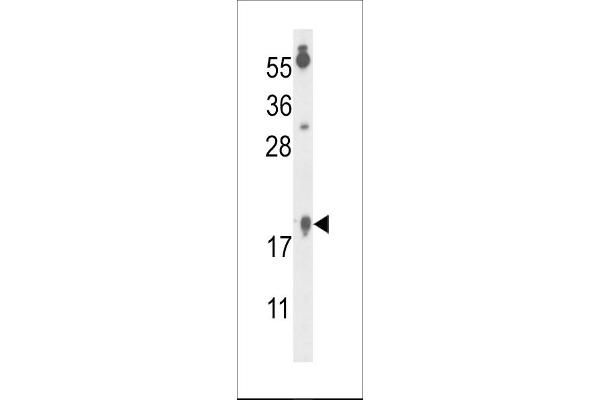 FAM96B Antikörper  (N-Term)