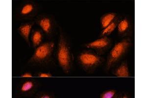 Immunofluorescence analysis of U-2 OS cells using SUPT6H Polyclonal Antibody at dilution of 1:100. (Spt6 Antikörper)