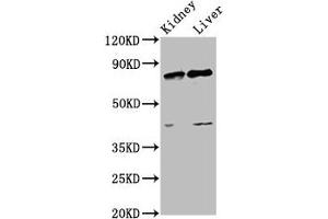 Western Blot Positive WB detected in: Rat kidney tissue, Rat liver tissue All lanes: SUZ12 antibody at 3. (SUZ12 Antikörper  (AA 131-305))