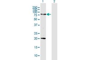 Western Blot analysis of FERMT1 expression in transfected 293T cell line by FERMT1 MaxPab polyclonal antibody. (FERMT1 Antikörper  (AA 1-677))