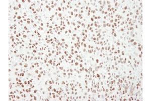 Immunohistochemistry (IHC) image for anti-Minichromosome Maintenance Complex Component 6 (MCM6) (C-Term) antibody (ABIN7448657) (MCM6 Antikörper  (C-Term))