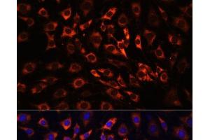 Immunofluorescence analysis of C6 cells using ERK1 / ERK2 Polyclonal Antibody at dilution of 1:100 (40x lens). (ERK1/2 Antikörper)