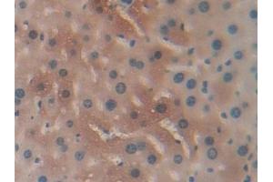 Immunohistochemistry (IHC) image for anti-serpin Peptidase Inhibitor, Clade A (Alpha-1 Antiproteinase, Antitrypsin), Member 6 (SERPINA6) (AA 268-391) antibody (ABIN7438403)