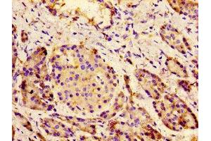 Immunohistochemistry of paraffin-embedded human pancreatic tissue using ABIN7175586 at dilution of 1:100 (CACNA1C Antikörper  (AA 1755-1971))