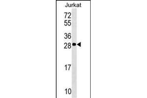 ANP32C Antibody (Center) (ABIN1537820 and ABIN2848975) western blot analysis in Jurkat cell line lysates (35 μg/lane). (ANP32C Antikörper  (AA 130-158))