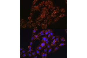 Immunofluorescence analysis of C6 cells using CHCHD2 antibody (ABIN7266448) at dilution of 1:100. (CHCHD2 Antikörper  (AA 75-145))