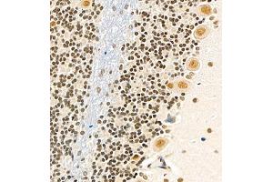 Immunohistochemistry of paraffin embedded rat cerebellum using USP27 (ABIN7076113) at dilution of 1:700 (400x lens) (USP27X Antikörper)