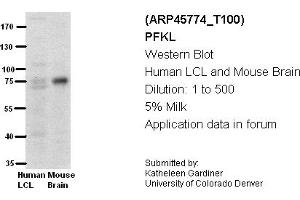 Image no. 2 for anti-Phosphofructokinase, Liver (PFKL) (Middle Region) antibody (ABIN2782359)
