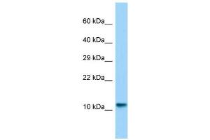 Host:  Rabbit  Target Name:  Lsm10  Sample Type:  Rat Testis lysates  Antibody Dilution:  1. (LSM10 Antikörper  (N-Term))