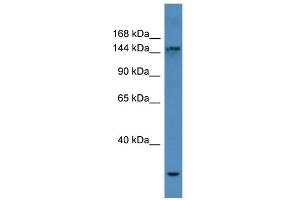 WB Suggested Anti-COL4A3 Antibody Titration: 0.