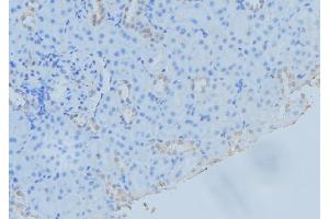 ABIN6279466 at 1/100 staining Mouse kidney tissue by IHC-P. (SAR1A Antikörper  (Internal Region))
