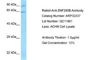 Western Blotting (WB) image for anti-Zinc Finger Protein 280B (ZNF280B) (N-Term) antibody (ABIN2779515) (ZNF280B Antikörper  (N-Term))
