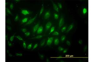 Immunofluorescence of monoclonal antibody to USP33 on HeLa cell.