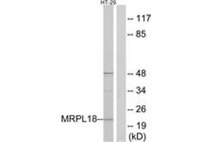 Western Blotting (WB) image for anti-Mitochondrial Ribosomal Protein L18 (MRPL18) (AA 1-50) antibody (ABIN2890051) (MRPL18 Antikörper  (AA 1-50))