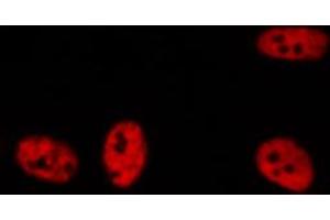 ABIN6272258 staining A549 by IF/ICC. (BRD3 Antikörper  (C-Term))