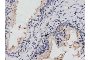 Immunohistochemical staining of paraffin-embedded Human prostate tissue using anti-PTPRE mouse monoclonal antibody. (PTPRE Antikörper)