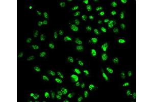Immunofluorescence analysis of A549 cell using SETD2 antibody.