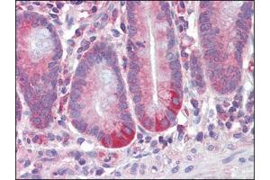 Human Small Intestine (formalin-fixed, paraffin-embedded) stained with RETNLBfollowed by biotinylated anti-goat IgG secondary antibody, alkaline phosphatase-streptavidin and chromogen. (RETNLB Antikörper  (Internal Region))