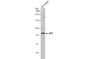 WB Image MX1 antibody detects MX1 protein by western blot analysis. (MX1 Antikörper  (Center))