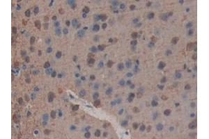 Immunohistochemistry (IHC) image for anti-phospholipase A2 Receptor 1, 180kDa (PLA2R1) (AA 1418-1487) antibody (ABIN7443389)