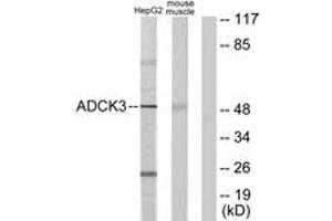 Western blot analysis of extracts from HepG2/mouse muscle cells, using ADCK3 Antibody. (COQ8A Antikörper  (AA 301-350))