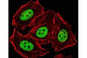 Fluorescent image of HeLa cells stained with GLI2 antibody diluted at 1:25 dilution. (GLI2 Antikörper  (C-Term))